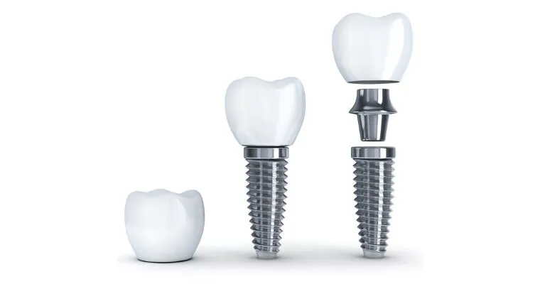 are dental implants safe for diabetics