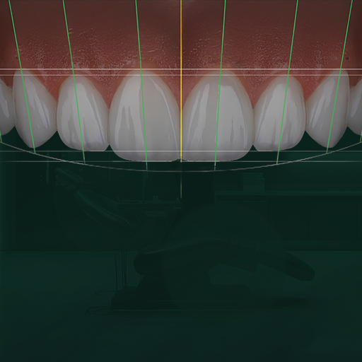 Digital Smile Design