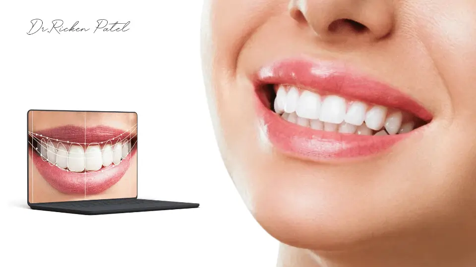 What Is Smile Design in Dentistry