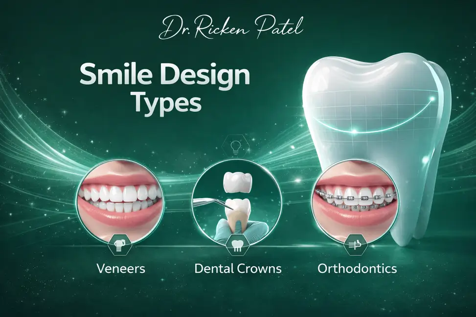 Smile Design Types