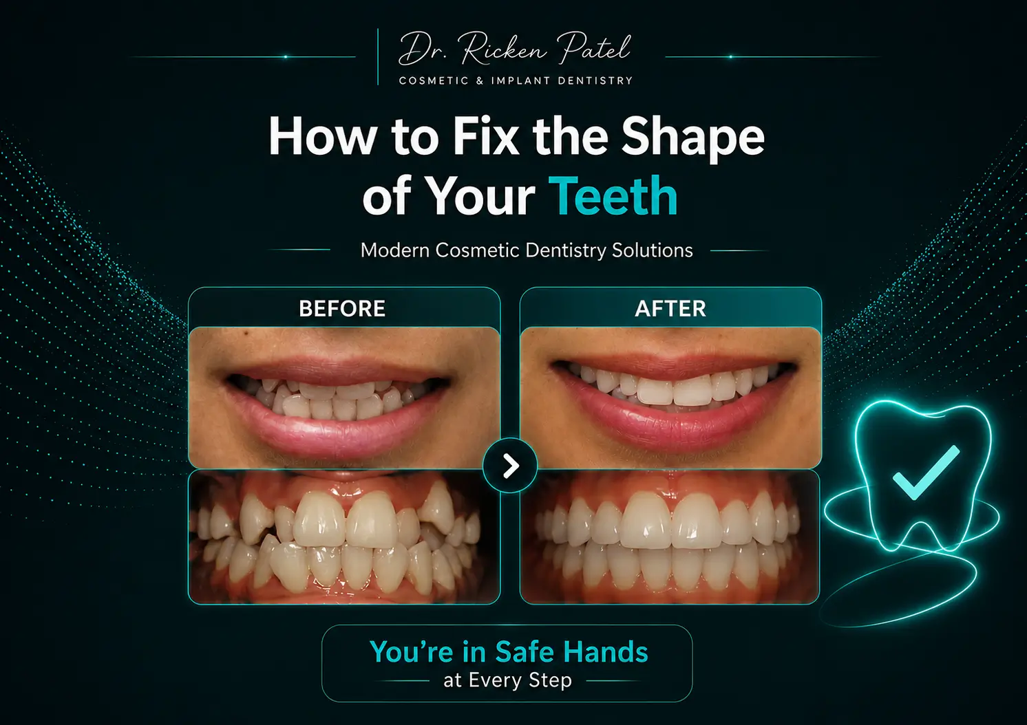How to Fix the Shape of Your Teeth