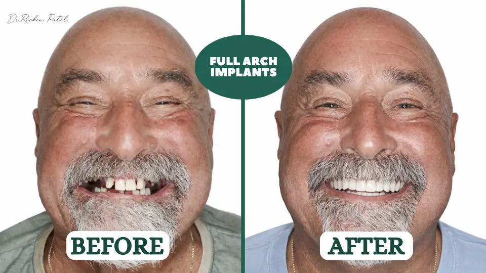 how to choose the best cosmetic dentist