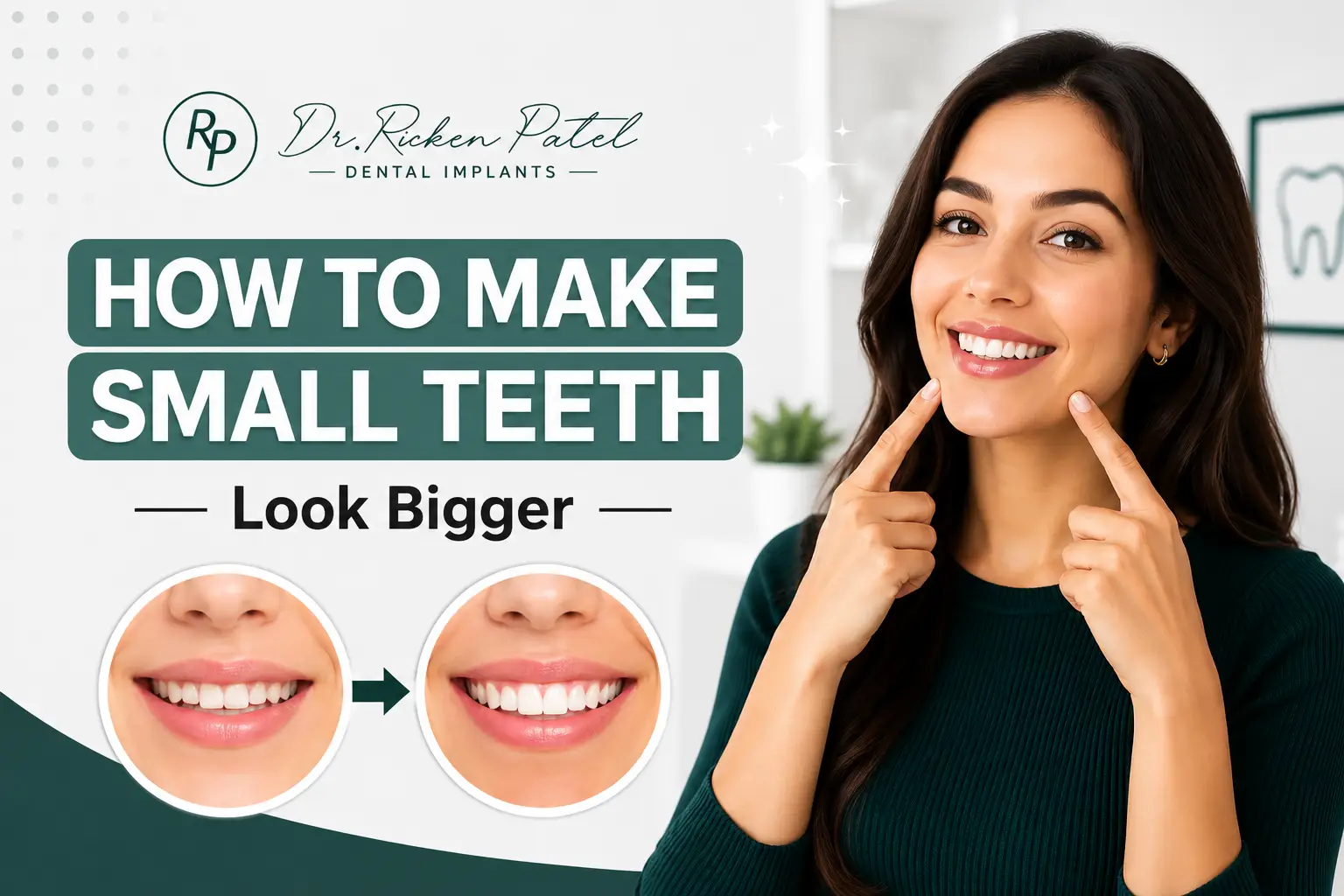 How to Make Small Teeth Look Bigger