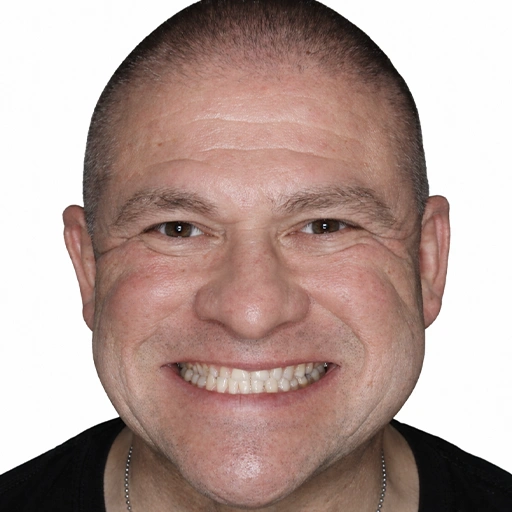 Cosmetic Dentist transformations before