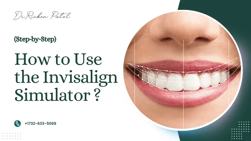 Invisalign Straight Teeth Simulator