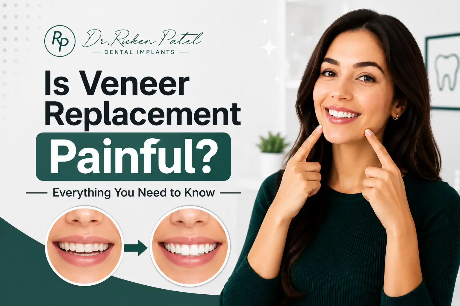 can veneers be removed or replaced can veneers be removed or replaced