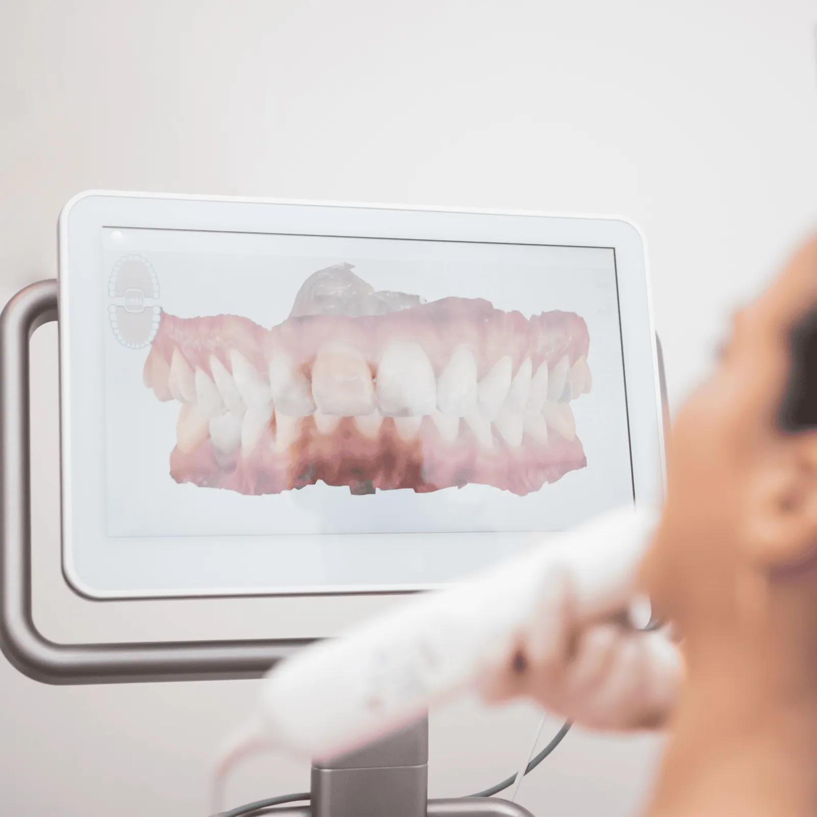 Dentist carrying out dental imaging to diagnose a patient at Smiles Family Dentistry
