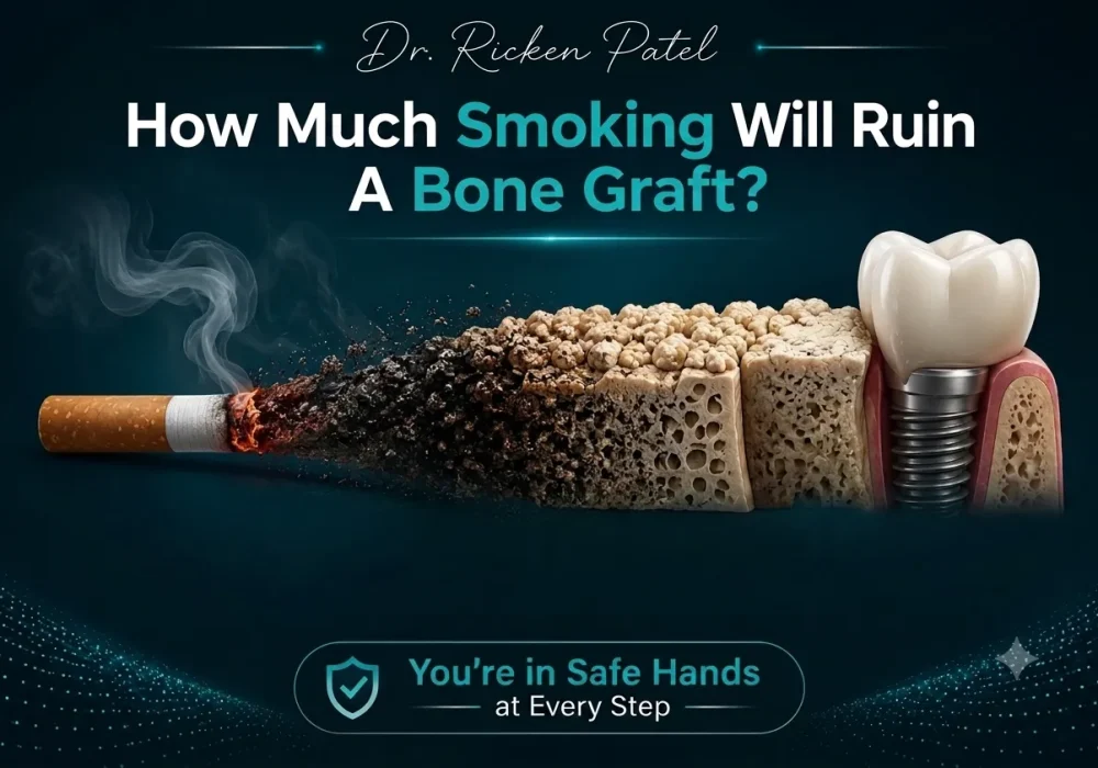 How Much Smoking Will Ruin A Bone Graft