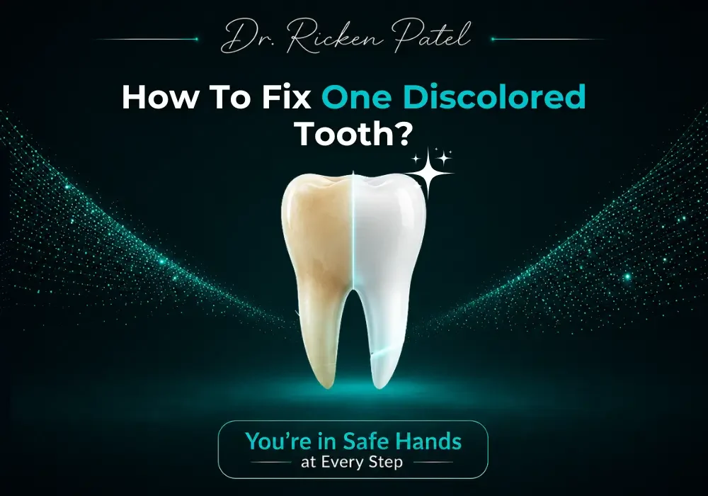 How To Fix One Discolored Tooth