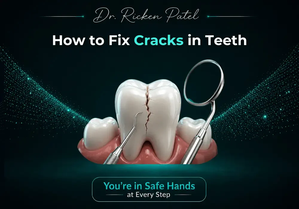 How to Fix Cracks in Teeth