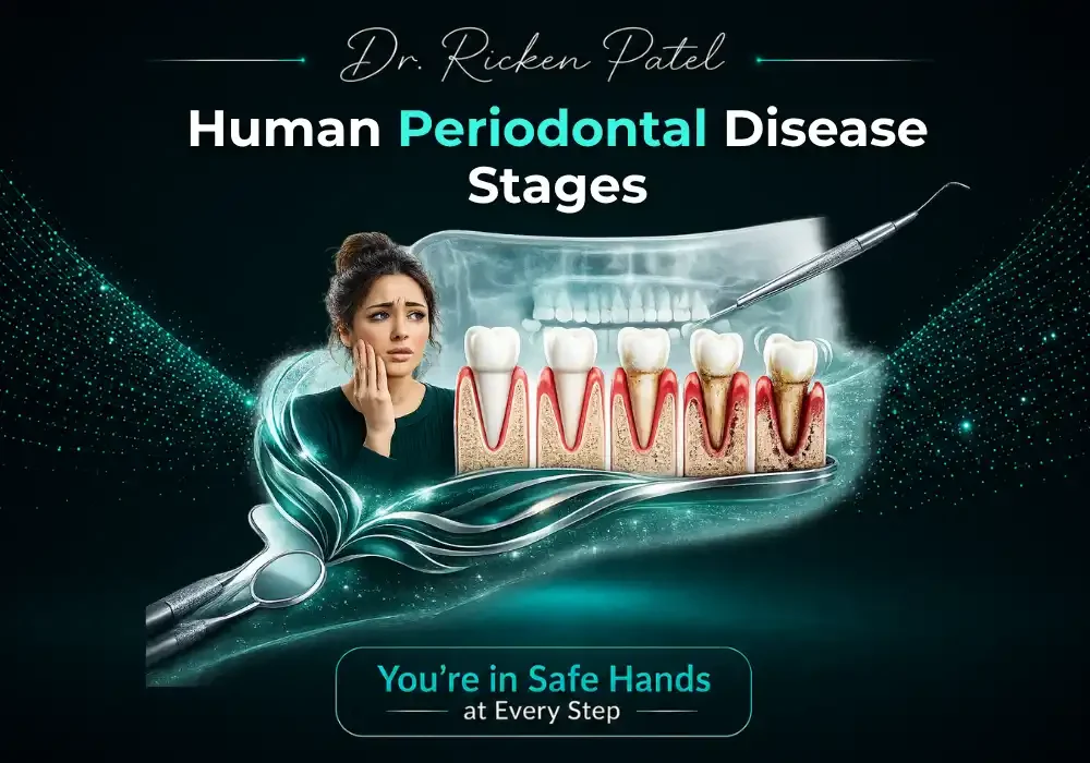 Human Periodontal Disease Stages