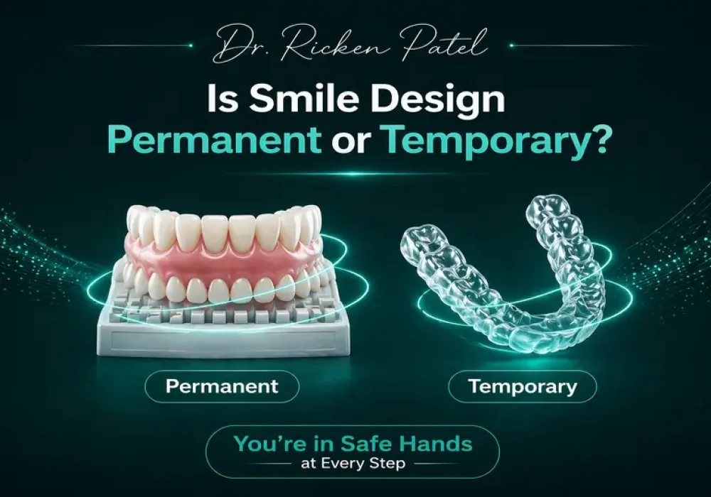 Is Smile Design Permanent