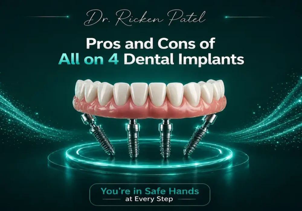 Pros and Cons of All-on-4 Dental Implants