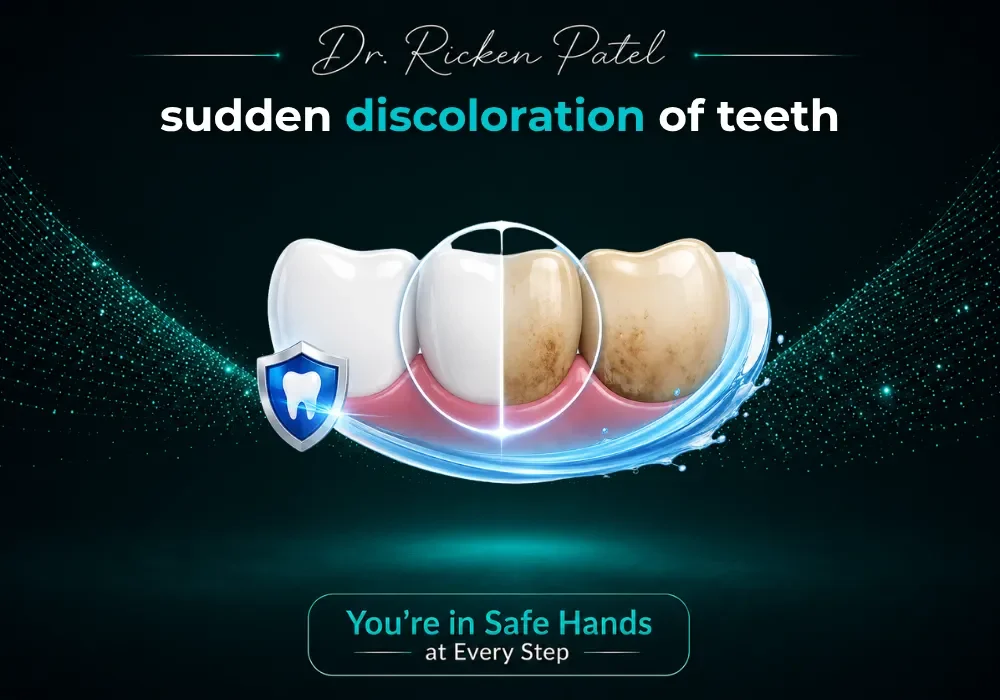 Sudden Discoloration of Teeth