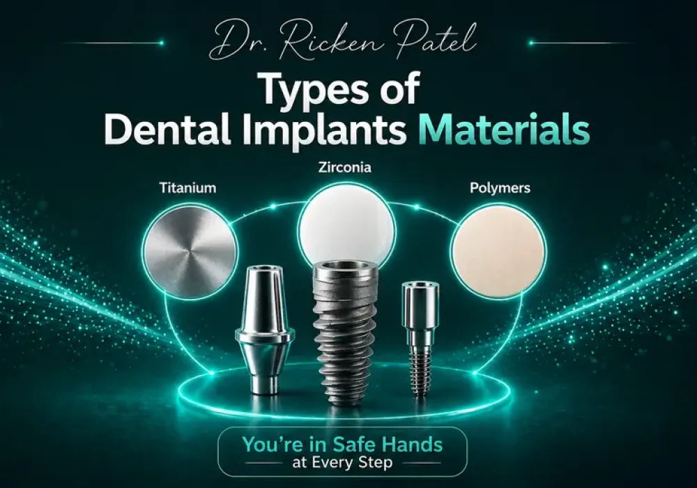 Types of Dental Implants Materials