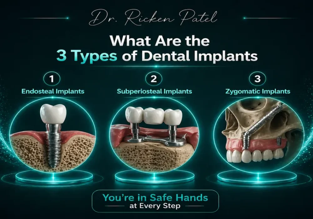 What Are the 3 Types of Dental Implants