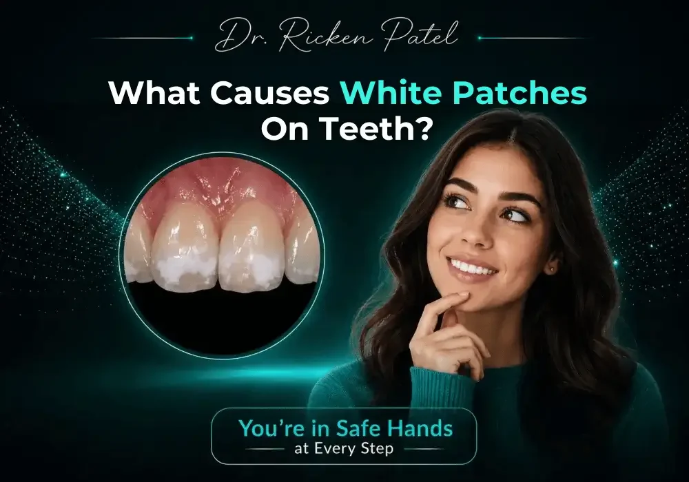 What Causes White Patches on Teeth