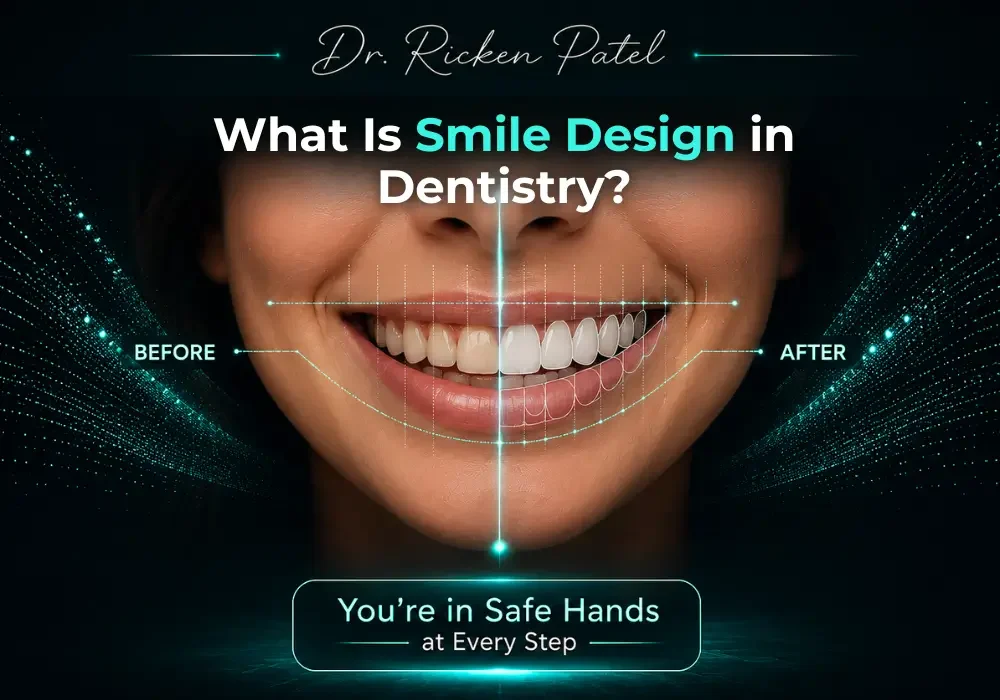 What Is Smile Design in Dentistry