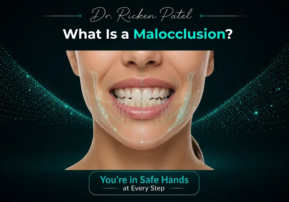 What Is a Malocclusion