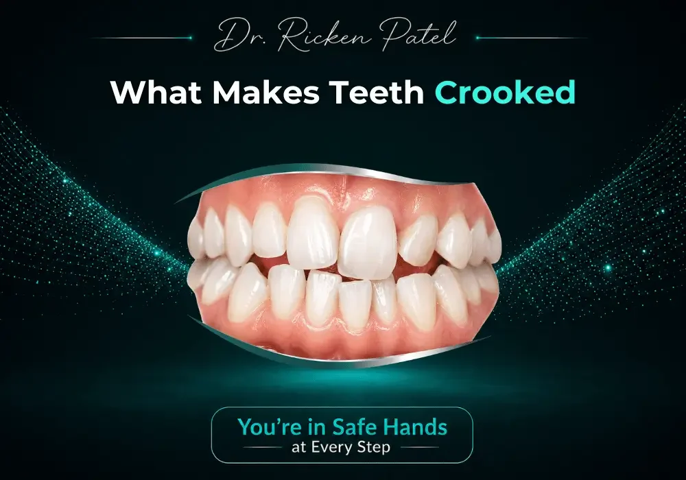 What Makes Teeth Crooked