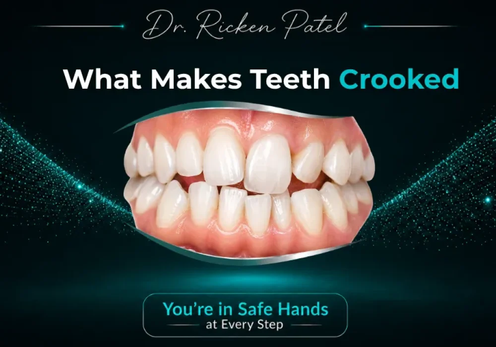 What Makes Teeth Crooked