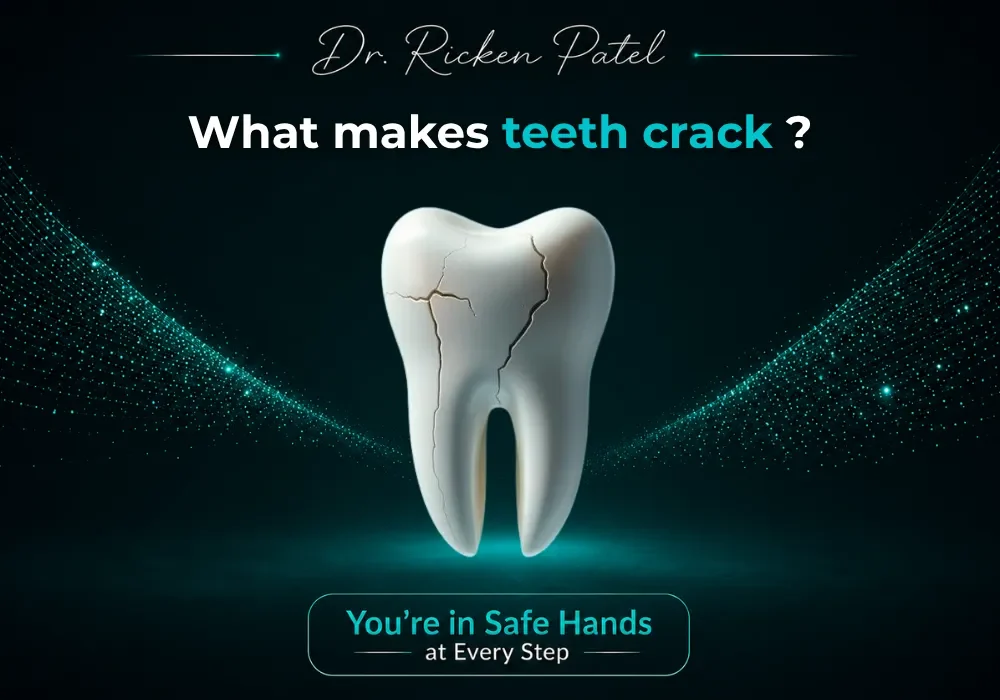 What makes teeth crack