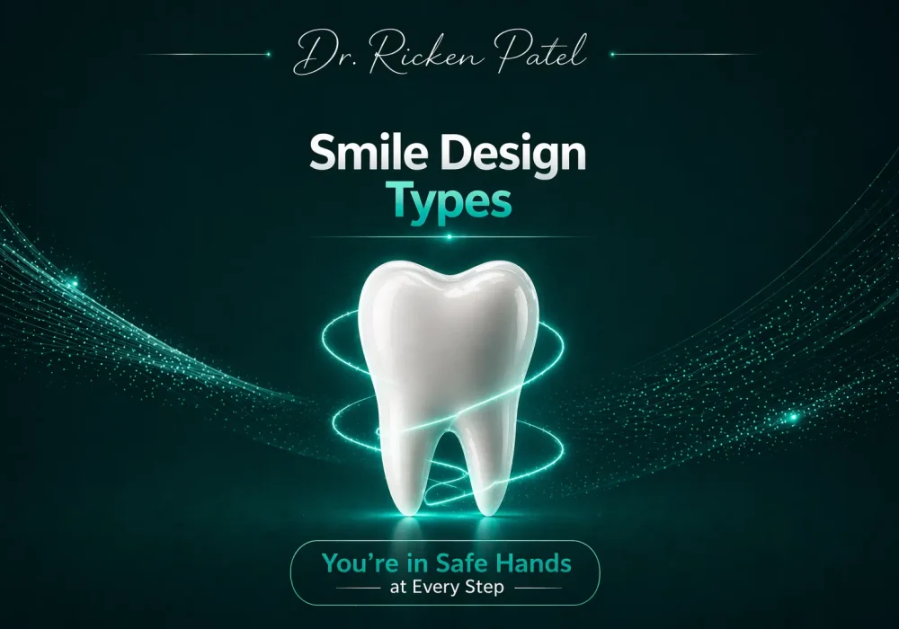 smile design types